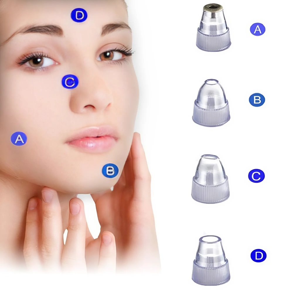 Elektromos, vákuumos pórus tisztító gép – a tökéletes megoldás a bőr tisztításához és frissítéséhez 8