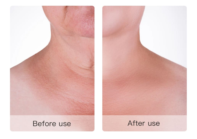 arc liftinh készülék 3