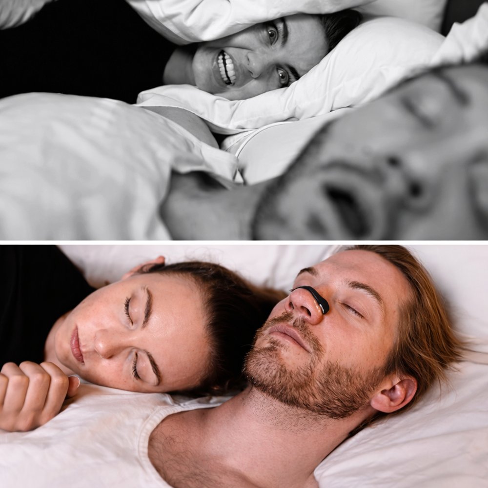 AirFlow Pro orrtágító készlet – horkolás ellen és orrdugulásra, alváshoz és sporthoz (BBM) 3